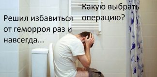 Каким лучше методом удалять геморрой