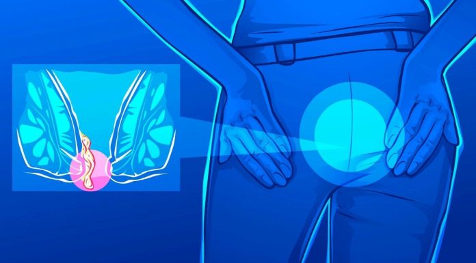 Можно ли как-то вылечить геморрой? Можно ли как-то вылечить геморрой?