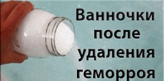 Ванночки после удаления геморроя Ванночки после удаления геморроя