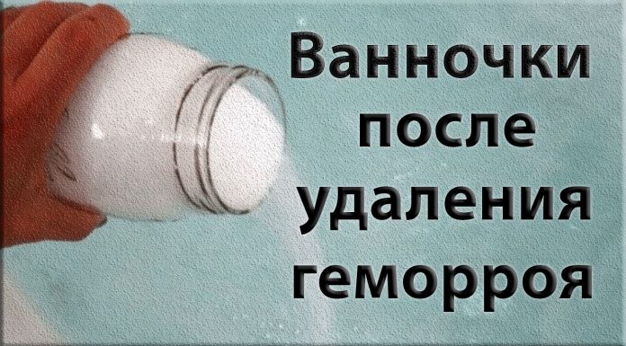 Какие ванночки рекомендуют при подагре. Йод при подагре: лечение подагры йодом Подагра [что это, симптомы и способы лечения у мужчин] Сауна при подагре можно ли в сауну при подагре