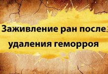 Как долго заживают раны после удаления геморроя Как долго заживают раны после удаления геморроя